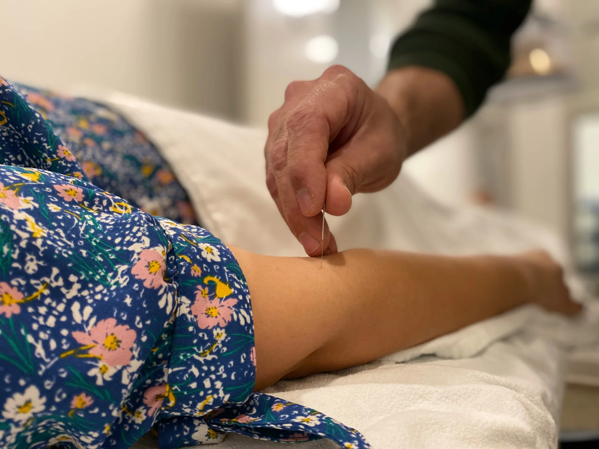 Pain Relief with Acupuncture